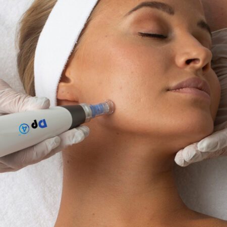 Microneedling Treatmnet at Imagine Spa